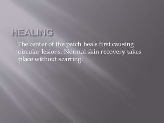 The center of the patch heals first causing
circular lesions. Normal skin recovery takes
place without scarring.
 