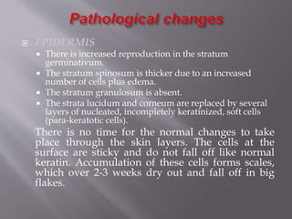  EPIDERMIS
 There is increased reproduction in the stratum
germinativum.
 The stratum spinosum is thicker due to an increased
number of cells plus edema.
 The stratum granulosum is absent.
 The strata lucidum and corneum are replaced by several
layers of nucleated, incompletely keratinized, soft cells
(para-keratotic cells).
There is no time for the normal changes to take
place through the skin layers. The cells at the
surface are sticky and do not fall off like normal
keratin. Accumulation of these cells forms scales,
which over 2-3 weeks dry out and fall off in big
flakes.
 