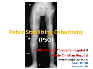Pelvic Stabilizing Osteotomy
(PSO)
CURE Ethiopia Children's Hospital &
Soddo Christian Hospital
By: Tewodros Asegie (BLH-OSR III)
October 27, 2017
January 16, 2018
 