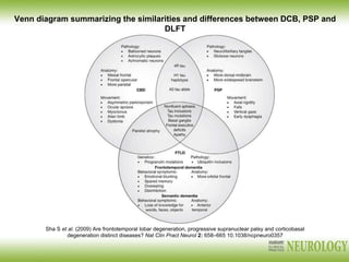 Sha S et al. (2009) Are frontotemporal lobar degeneration, progressive supranuclear palsy and corticobasal
degeneration distinct diseases? Nat Clin Pract Neurol 2: 658–665 10.1038/ncpneuro0357
Venn diagram summarizing the similarities and differences between DCB, PSP and
DLFT
 