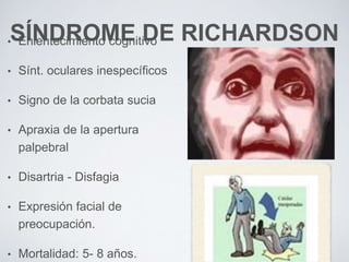 SÍNDROME DE RICHARDSON• Enlentecimiento cognitivo
• Sínt. oculares inespecíficos
• Signo de la corbata sucia
• Apraxia de la apertura
palpebral
• Disartria - Disfagia
• Expresión facial de
preocupación.
• Mortalidad: 5- 8 años.
 