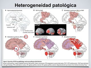 Heterogeneidad patológica
 