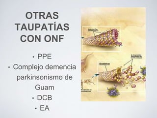 OTRAS
TAUPATÍAS
CON ONF
• PPE
• Complejo demencia
parkinsonismo de
Guam
• DCB
• EA
 