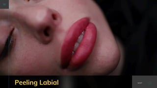 Peeling Labial NEXT
 