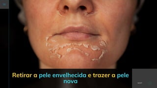 Retirar a pele envelhecida e trazer a pele
nova NEXT
 