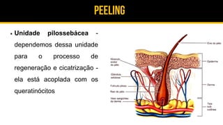 Peeling
Unidade pilossebácea -
dependemos dessa unidade
para o processo de
regeneração e cicatrização -
ela está acoplada com os
queratinócitos
 