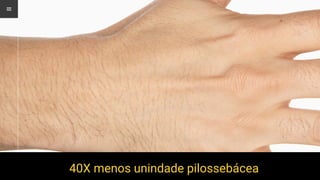 40X menos unindade pilossebácea
 
