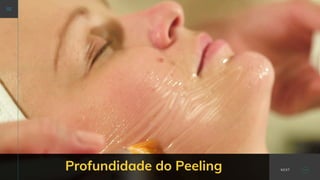 Profundidade do Peeling NEXT
 