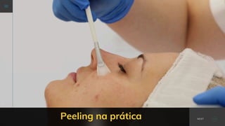 NEXT
Peeling na prática NEXT
 