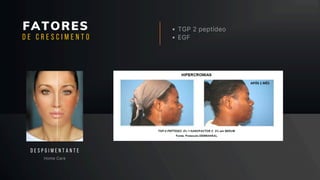 FATORES TGP 2 peptídeo
EGF
Home Care
D E S P G I M E N T A N T E
D E C R E S C I M E N T O
 