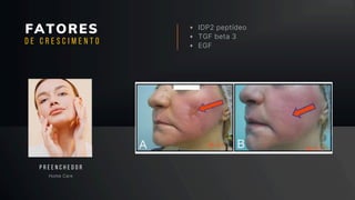 FATORES IDP2 peptídeo
TGF beta 3
EGF
Home Care
P R E E N C H E D O R
D E C R E S C I M E N T O
 