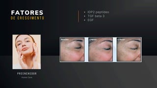 FATORES IDP2 peptídeo
TGF beta 3
EGF
Home Care
P R E E N C H E D O R
D E C R E S C I M E N T O
 