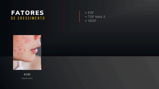 FATORES EGF
TGF beta 3
VEGF
Home Care
A C N E
D E C R E S C I M E N T O
 