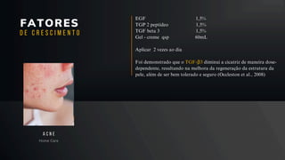FATORES
Home Care
A C N E
D E C R E S C I M E N T O
EGF 1,5%
TGP 2 peptídeo 1,5%
TGF beta 3 1,5%
Gel - creme qsp 60mL
Aplicar 2 vezes ao dia
Foi demonstrado que o TGF-β3 diminui a cicatriz de maneira dose-
dependente, resultando na melhora da regeneração da estrutura da
pele, além de ser bem tolerado e seguro (Occleston et al., 2008)
 