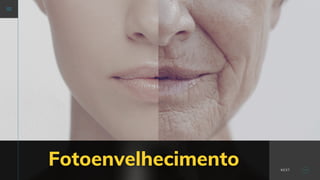 Fotoenvelhecimento NEXT
 