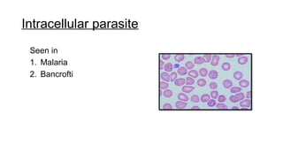Intracellular parasite
Seen in
1. Malaria
2. Bancrofti
 