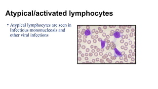Atypical/activated lymphocytes
• Atypical lymphocytes are seen in
Infectious mononucleosis and
other viral infections
 