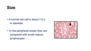 Size
• A normal red cell is about 7.2 µ
in diameter
• In the peripheral smear they are
compared with small mature
lymphocytes
 