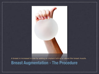 A breast is increased in size by adding an implant behind or above the breast muscle.


Breast Augmentation - The Procedure
 