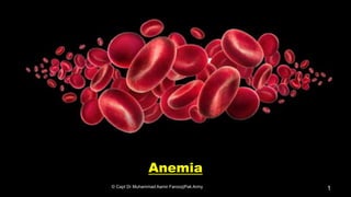 Anemia
© Capt Dr Muhammad Aamir Farooq|Pak Army 1
 