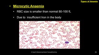 Anemia its types , causes , clinical findings | PPTX | Blood Disorders ...