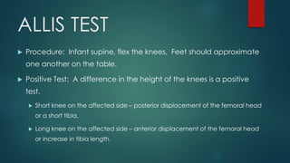 PS SESSION : EXAMINATION OF HIP | PDF