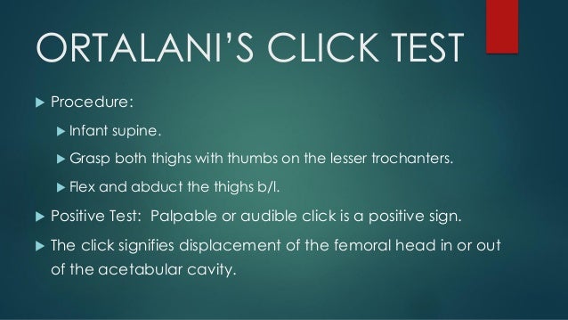 PS SESSION : EXAMINATION OF HIP slideshare