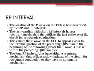 What Is Rp Interval Psvt | PPTX