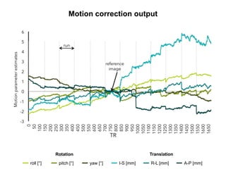 roll [°] pitch [°] yaw [°] I-S [mm] R-L [mm] A-P [mm]
Rotation Translation
Motion correction output
 