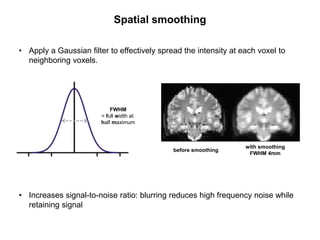 • Apply a Gaussian filter to effectively spread the intensity at each voxel to
neighboring voxels.
• Increases signal-to-noise ratio: blurring reduces high frequency noise while
retaining signal
Spatial smoothing
FWHM
= full width at
half maximum
before smoothing
with smoothing
FWHM 4mm
 