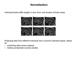 Normalization
Individual brains differ largely in size, form, and location of brain areas
Projecting data from different individual into a common standard space, allows
for
• combining data across subjects
• making comparisons across studies
 