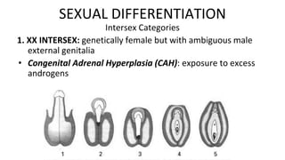 61
Intersex Categories
1. XX INTERSEX: genetically female but with ambiguous male
external genitalia
• Congenital Adrenal Hyperplasia (CAH): exposure to excess
androgens
SEXUAL DIFFERENTIATION
 