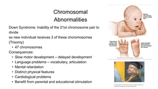 Down Syndrome: Inability of the 21st chromosome pair to
divide
so new individual receives 3 of these choromosomes
(Trisomy)
• 47 chromosomes
Consequences:
• Slow motor development – delayed development
• Language problems – vocabulary, articulation
• Mental retardation
• Distinct physical features
• Cardiological problems
• Benefit from parental and educational stimulation
Chromosomal
Abnormalities
 