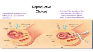 Reproductive
Choices
Amniocentesis: a sample of fluid
in the uterus. 1-2 weeks from
conception
Chorionic Villus Sampling: a thin
tube inserted from vagina to
uterus, examine cells’ genetic
defect. 9 weeks from conception
 