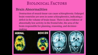 Schizophrenia Class Report (MENTAL DISORDER)