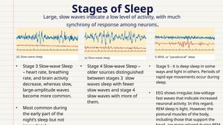 Stages of Sleep
Large, slow waves indicate a low level of activity, with much
synchrony of response among neurons.
• Stage 3 Slow-wave Sleep
– heart rate, breathing
rate, and brain activity
decrease, whereas slow,
large-amplitude waves
become more common.
• Most common during
the early part of the
night’s sleep but not
• Stage 5 - it is deep sleep in some
ways and light in others. Periods of
rapid eye movements occur during
sleep.
• EEG shows irregular, low-voltage
fast waves that indicate increased
neuronal activity. In this regard,
REM sleep is light, However, the
postural muscles of the body,
including those that support the
• Stage 4 Slow-wave Sleep –
older sources distinguished
between stages 3 slow
waves sleep with fewer
slow waves and stage 4
slow waves with more of
them.
 