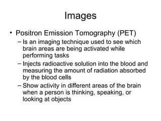 Images Positron Emission Tomography (PET) Is an imaging technique used to see which brain areas are being activated while performing tasks Injects radioactive solution into the blood and measuring the amount of radiation absorbed by the blood cells Show activity in different areas of the brain when a person is thinking, speaking, or looking at objects 