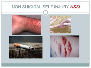 NON SUICIDAL SELF INJURY NSSI
 