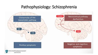 Pathophysiology: Schizophrenia
 