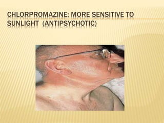 Psychological aspects of skin disease | PPTX
