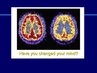 Have you changed your mind? 