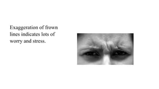 Exaggeration of frown
lines indicates lots of
worry and stress.
 