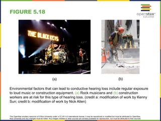 This OpenStax ancillary resource is © Rice University under a CC-BY 4.0 International license; it may be reproduced or modified but must be attributed to OpenStax,
Rice University and any changes must be noted. Any images credited to other sources are similarly available for reproduction, but must be attributed to their sources.
Environmental factors that can lead to conductive hearing loss include regular exposure
to loud music or construction equipment. (a) Rock musicians and (b) construction
workers are at risk for this type of hearing loss. (credit a: modification of work by Kenny
Sun; credit b: modification of work by Nick Allen)
FIGURE 5.18
 