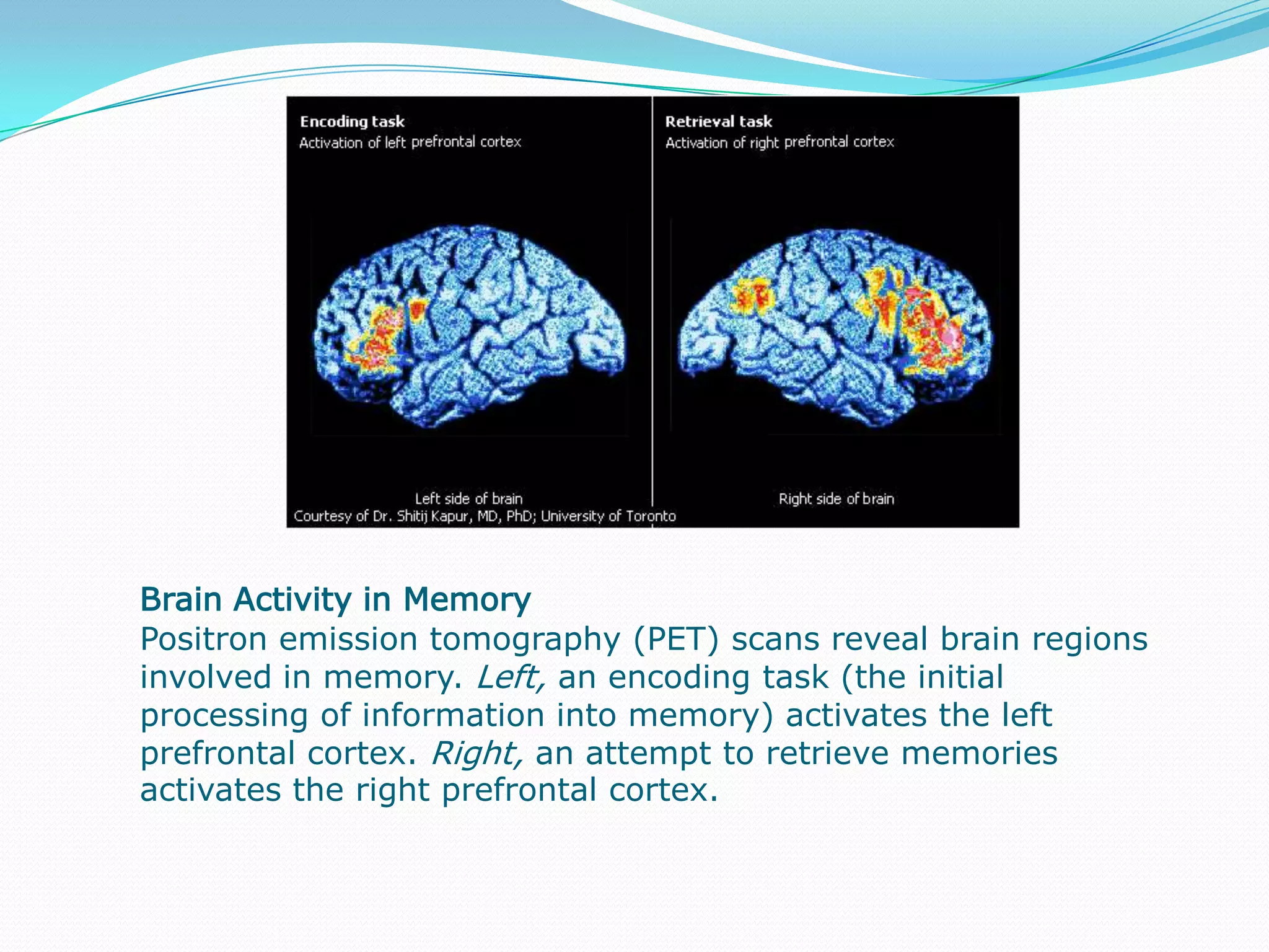                                                                     Brain Activity in Bipolar DisorderThese positron emission tomography scans of the brain of a person with bipolar disorder show the individual shifting from depression, top row, to mania, middle row, and back to depression, bottom row, over the course of 10 days. Blue and green indicate low levels of brain activity, while red, orange, and yellow indicate high levels of brain activity.