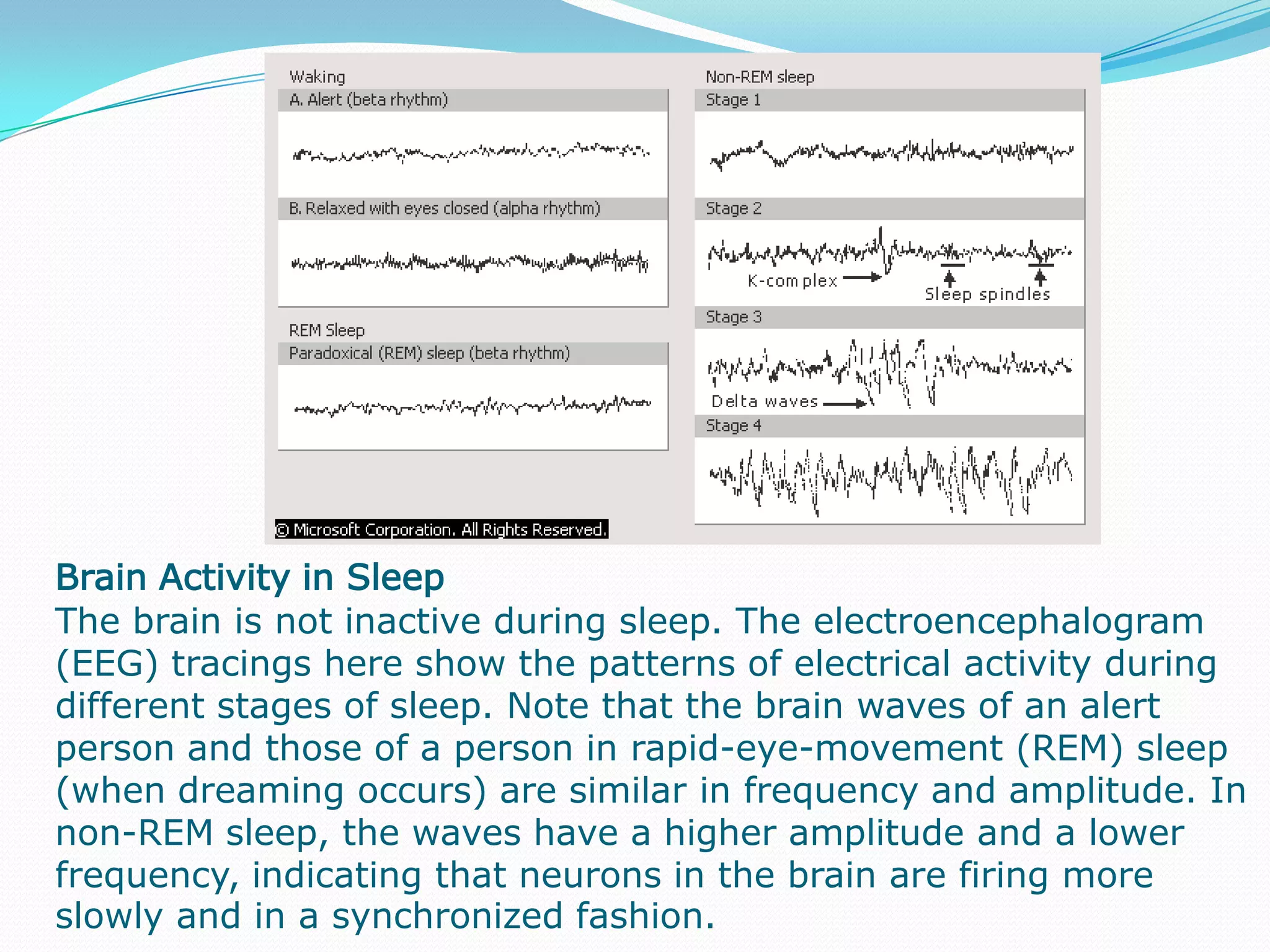                                                        Positron Emission TomographyThis positron emission tomography (PET) scan of the brain shows the activity of brain cells in the resting state and during three types of auditory stimulation. PET uses radioactive substances introduced into the brain to measure such brain functions as cerebral metabolism, blood flow and volume, oxygen use, and the formation of neurotransmitters. This imaging method X-rays the brain from many different angles, feeding the information into a computer that produces a series of cross-sectional images.                                                                                       Grand Mal Seizure EEGThe electroencephalograph (EEG) pattern of a normal individual, left, shows low amplitude tracings from each of the electrodes that have been placed on the head. In an EEG pattern from an individual suffering from a grand mal seizure, right, these tracings exhibit both a high amplitude and an erratic pattern lasting for several minutes.