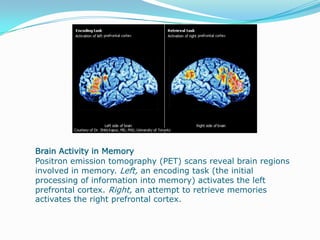                                                                      Brain Activity in Bipolar DisorderThese positron emission tomography scans of the brain of a person with bipolar disorder show the individual shifting from depression, top row, to mania, middle row, and back to depression, bottom row, over the course of 10 days. Blue and green indicate low levels of brain activity, while red, orange, and yellow indicate high levels of brain activity.