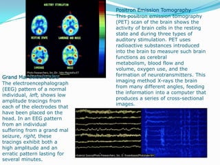                                                                                     Brain Activity in MemoryPositron emission tomography (PET) scans reveal brain regions involved in memory. Left, an encoding task (the initial processing of information into memory) activates the left prefrontal cortex. Right, an attempt to retrieve memories activates the right prefrontal cortex.
