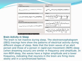                                                        Positron Emission TomographyThis positron emission tomography (PET) scan of the brain shows the activity of brain cells in the resting state and during three types of auditory stimulation. PET uses radioactive substances introduced into the brain to measure such brain functions as cerebral metabolism, blood flow and volume, oxygen use, and the formation of neurotransmitters. This imaging method X-rays the brain from many different angles, feeding the information into a computer that produces a series of cross-sectional images.                                                                                       Grand Mal Seizure EEGThe electroencephalograph (EEG) pattern of a normal individual, left, shows low amplitude tracings from each of the electrodes that have been placed on the head. In an EEG pattern from an individual suffering from a grand mal seizure, right, these tracings exhibit both a high amplitude and an erratic pattern lasting for several minutes.
