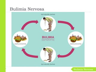 Bulimia Nervosa
Bulimia Nervosa
 