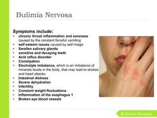Symptoms include:
▶ chronic throat inflammation and soreness
caused by the constant forceful vomiting
▶ self esteem issues caused by self image
▶ Swollen salivary glands
▶ sensitive and decaying teeth
▶ Acid reflux disorder
▶ Constipation
▶ Electrolyte imbalance, which is an imbalance of
minerals levels in the body, that may lead to strokes
and heart attacks.
▶ Intestinal distress
▶ Severe dehydration
▶ Infertility
▶ Constant weight fluctuations
▶ Inflammation of the esophagus 1
▶ Broken eye blood vessels
Bulimia Nervosa
Bulimia Nervosa
 